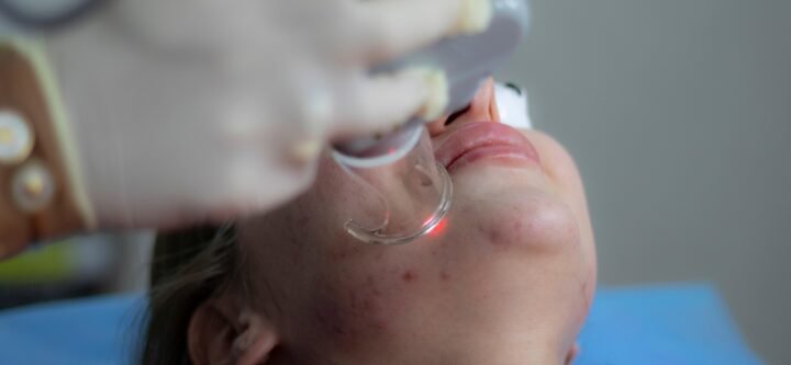 laser-treatment-6664875_1280