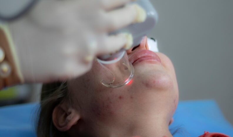 laser-treatment-6664875_1280